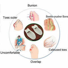 Unisex Silicone Bunion Splint & Toe Separator for Hallux Valgus Relief