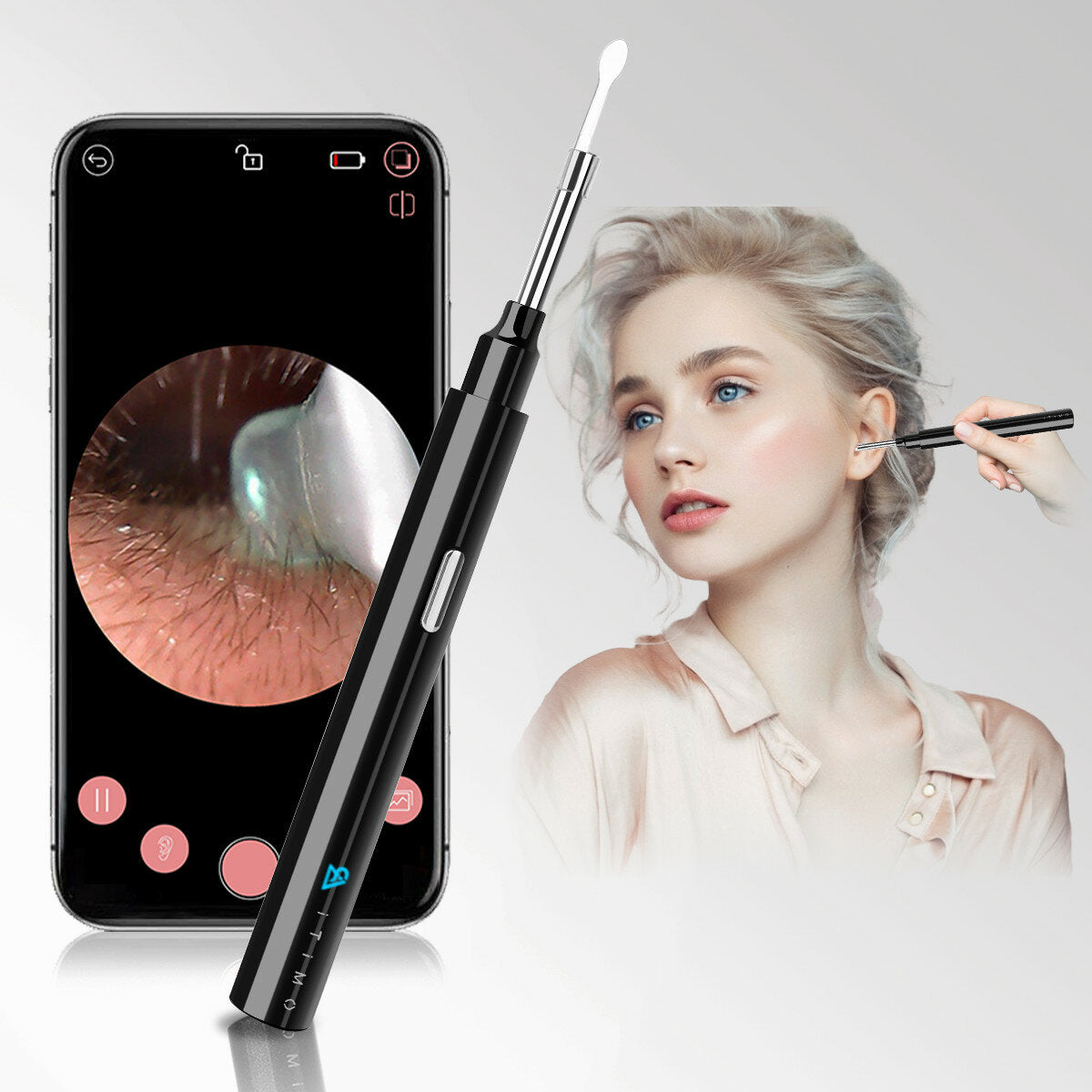 Smart Visible Earpick: Rechargeable 200W Pixel, IP67 Waterproof Lens, Earwax Remover Cleaner