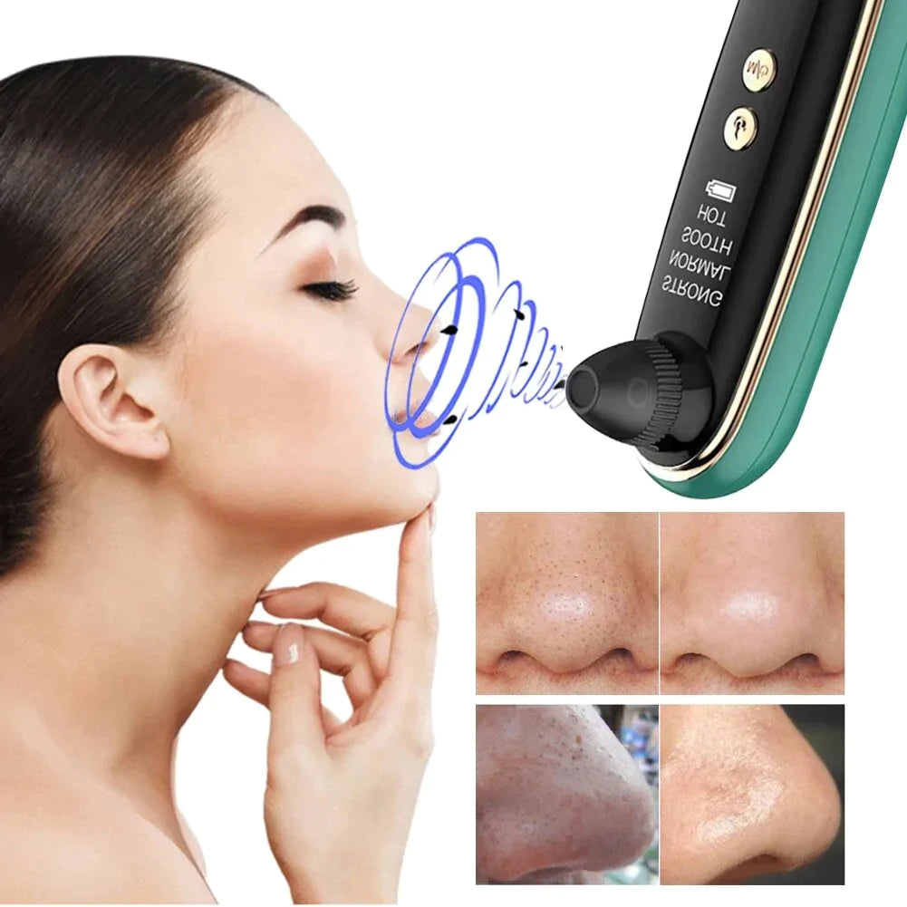 Multi-Gear Skin-Friendly WiFi Camera Blackhead Remover for Facial Cleaning and Skin Care