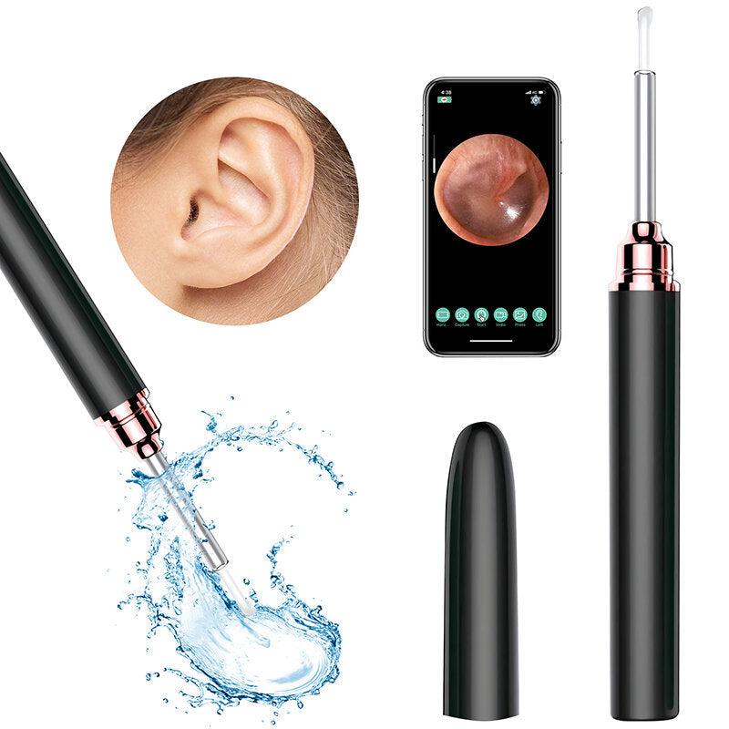 1080P HD WiFi Ear Wax Removal Camera - Wireless Otoscope with 360 Degree Visual Ear Scope, Safe Ear Pick for Adults & Kids