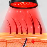 LLLT Hair & Scalp Wellness Helmet | Laser Therapy Device (Up to 272 Diodes)