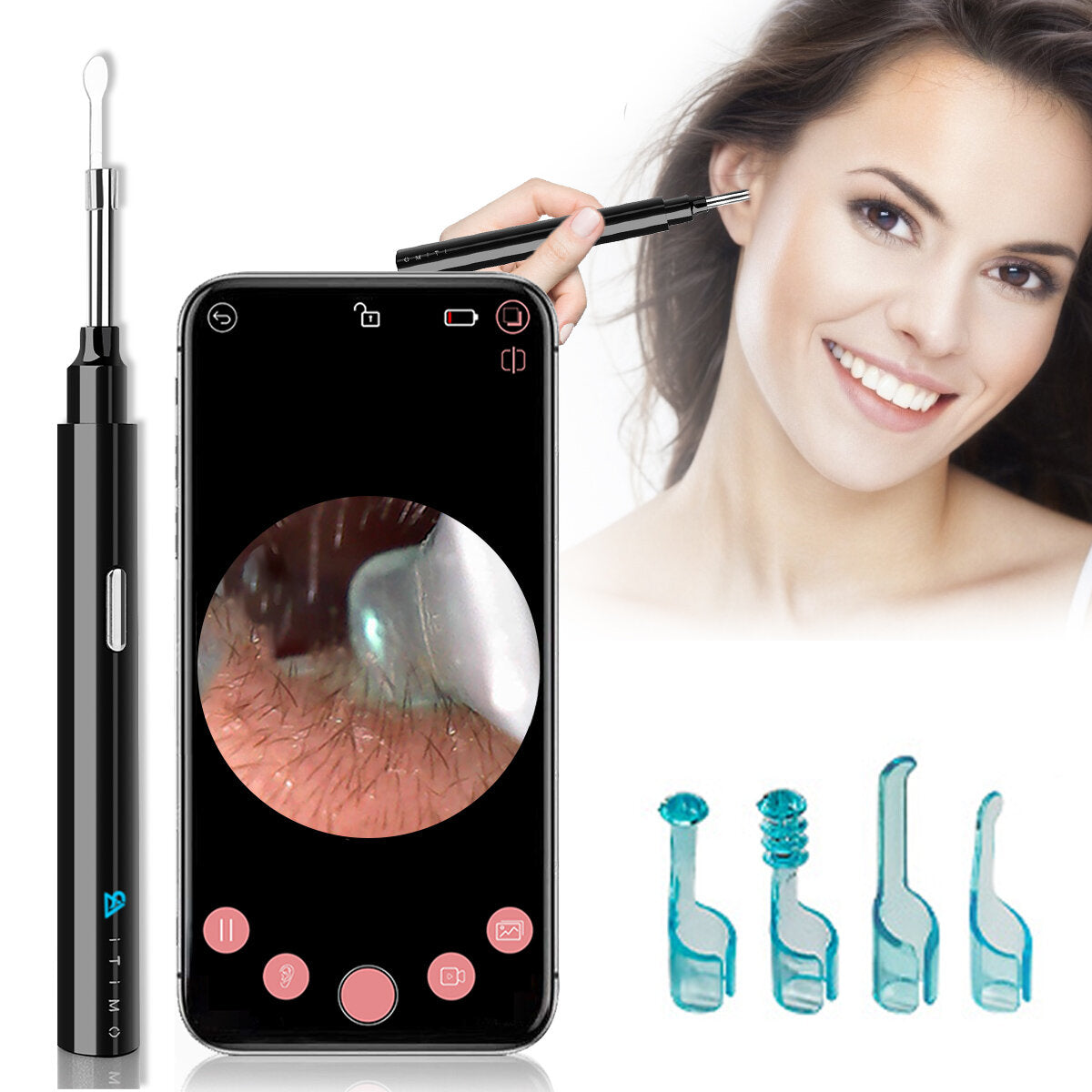 Smart Visible Earpick: Rechargeable 200W Pixel, IP67 Waterproof Lens, Earwax Remover Cleaner