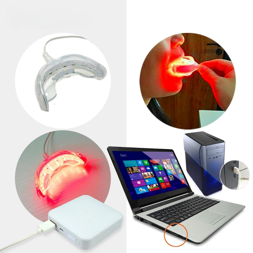 Red Light Therapy for Gums & Teeth, 625nm LED Oral Care Device for Periodontal Treatment, Toothache & Sensitivity Relief