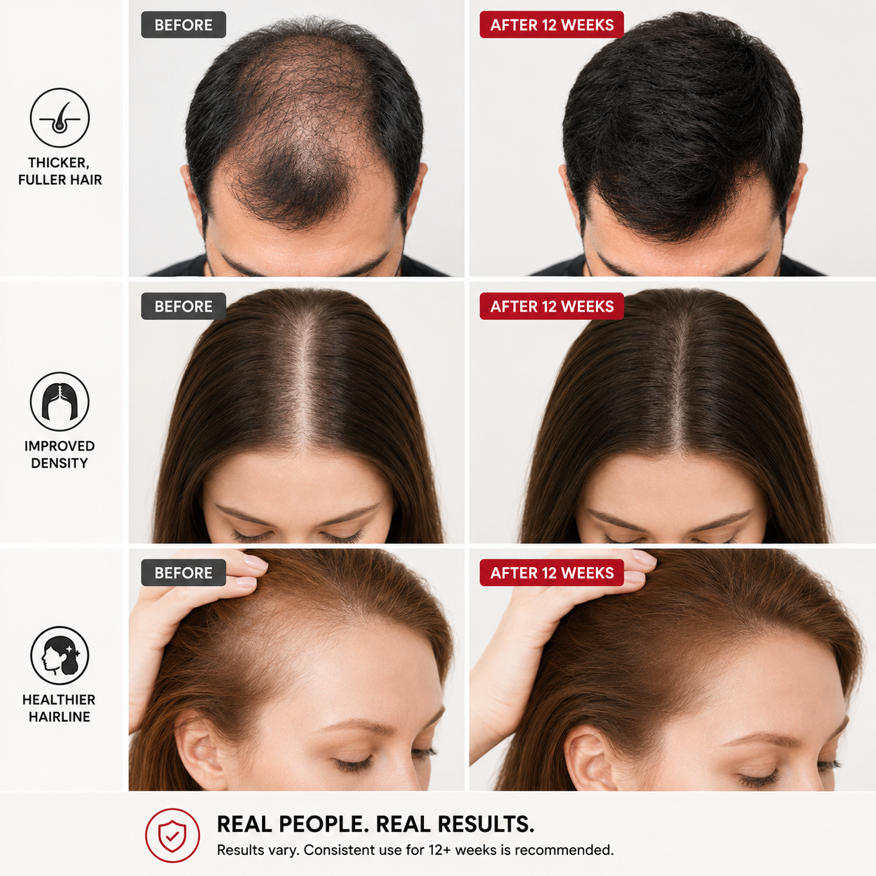7hw StrandAir | Fully Integrated Wireless LED Scalp Wellness System