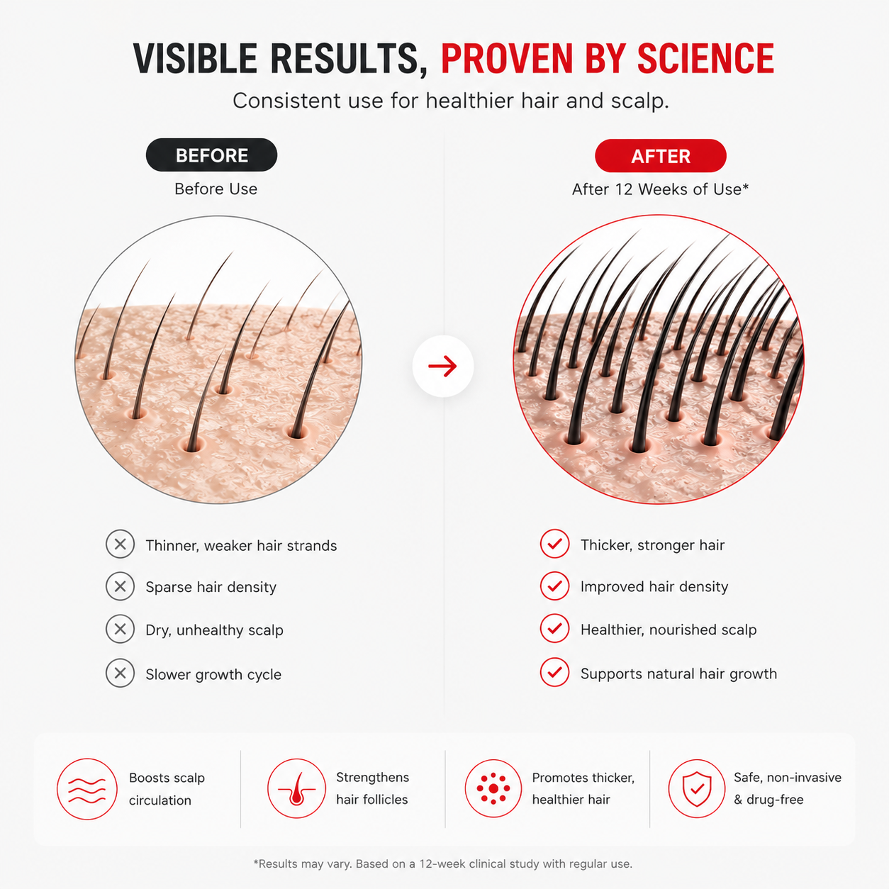 NeoStrand™ Elite | Advanced Full Laser Hair Recovery System