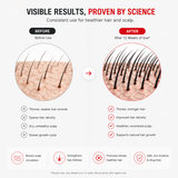 NeoStrand™ Elite | Advanced Full Laser Hair Recovery System