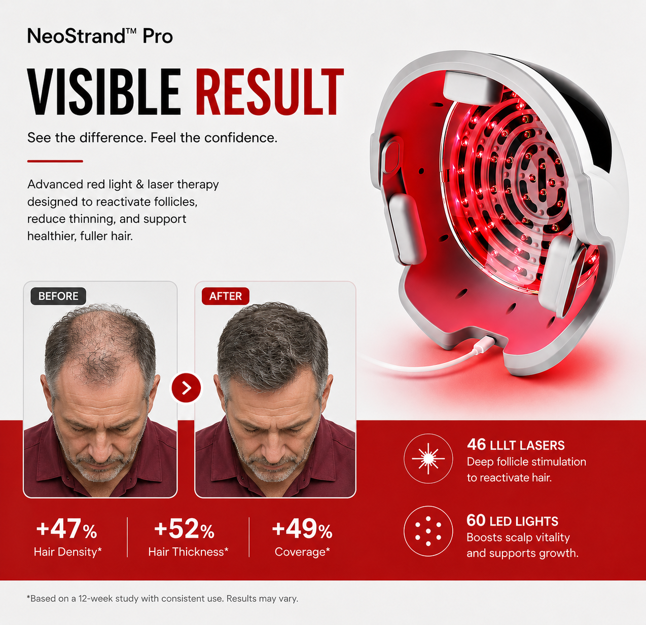 7hw StrandPro | Advanced Laser + LED Hair Wellness System: