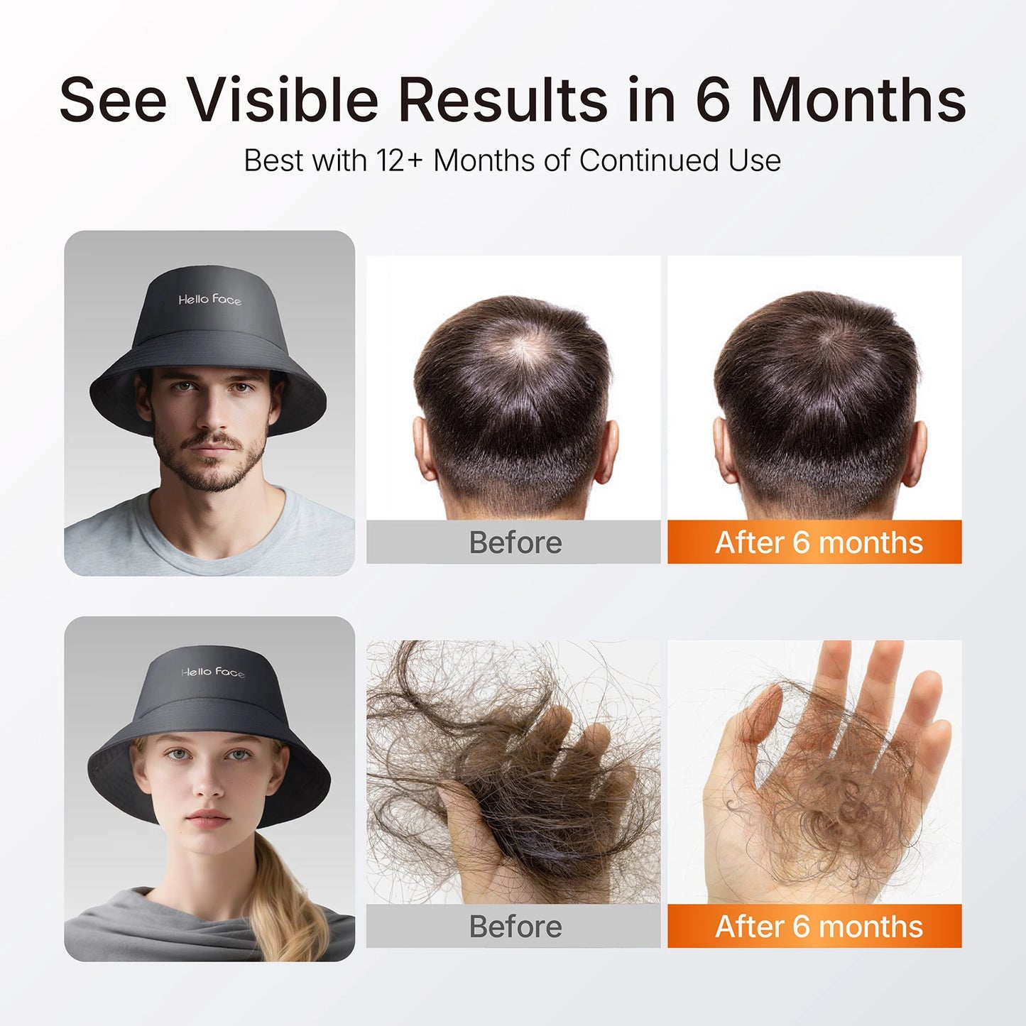 Red Light Therapy Hair Growth Cap | 336 LED Scalp Wellness Bucket Hat