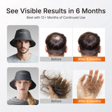 Red Light Therapy Hair Growth Cap | 336 LED Scalp Wellness Bucket Hat