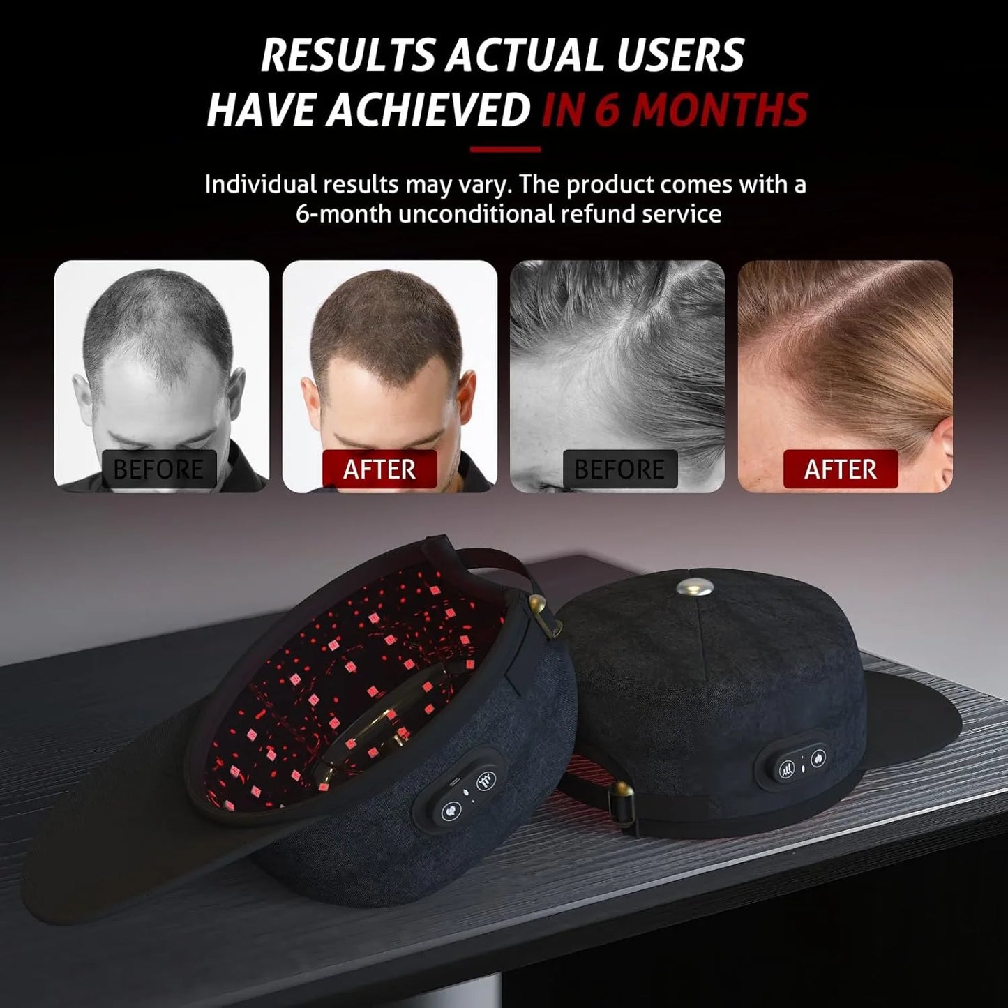 Wireless LLLT Laser Hair Growth Cap, Class II 660nm 850nm Low Level Laser Therapy Hat for Hair Regrowth & Anti Hair Loss