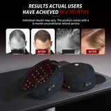 Wireless LLLT Laser Hair Growth Cap, Class II 660nm 850nm Low Level Laser Therapy Hat for Hair Regrowth & Anti Hair Loss