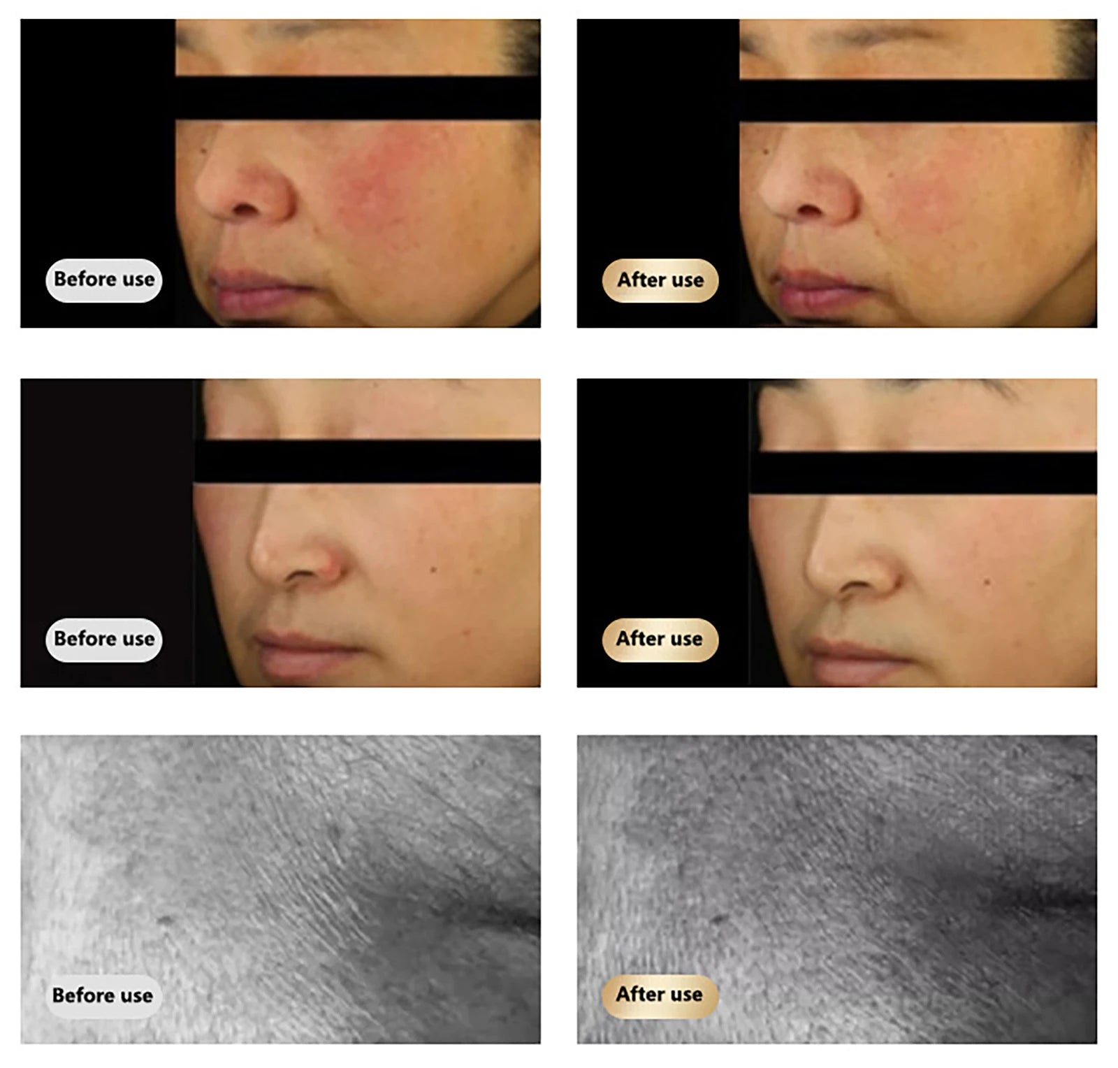 Rechargeable Red & Near Infrared LED Light Therapy Face Mask - 630nm & 830nm - 10-Minute Timer for Home & Travel Skincare
