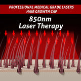 Wireless LLLT Laser Hair Growth Cap, Class II 660nm 850nm Low Level Laser Therapy Hat for Hair Regrowth & Anti Hair Loss