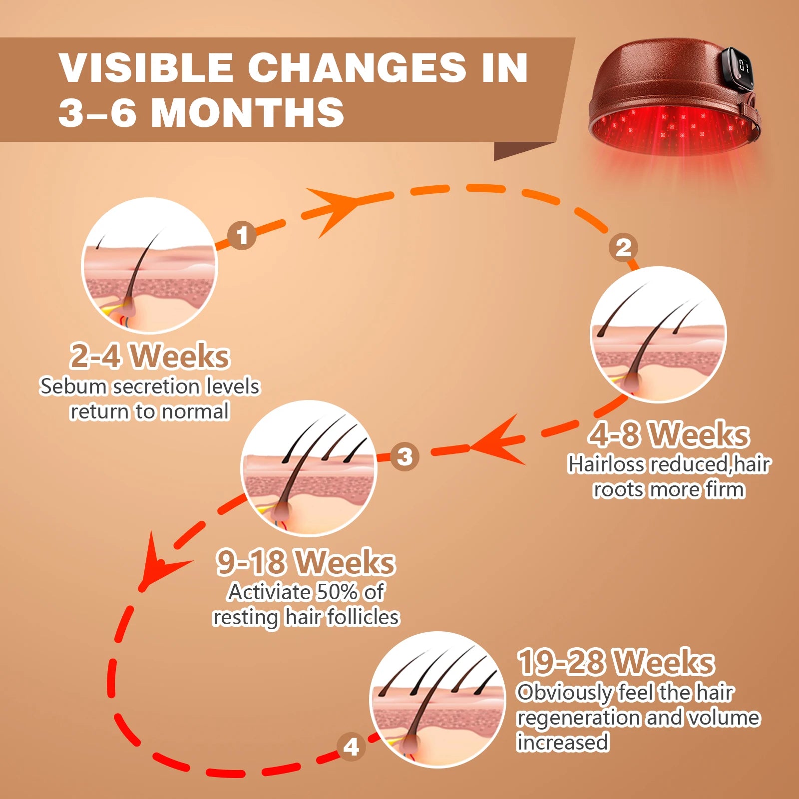 Wireless Red Light Therapy Cap for Hair Regrowth, 120 LEDs 660nm 850nm Infrared Hat for Anti-Hair Loss & Thicker Hair