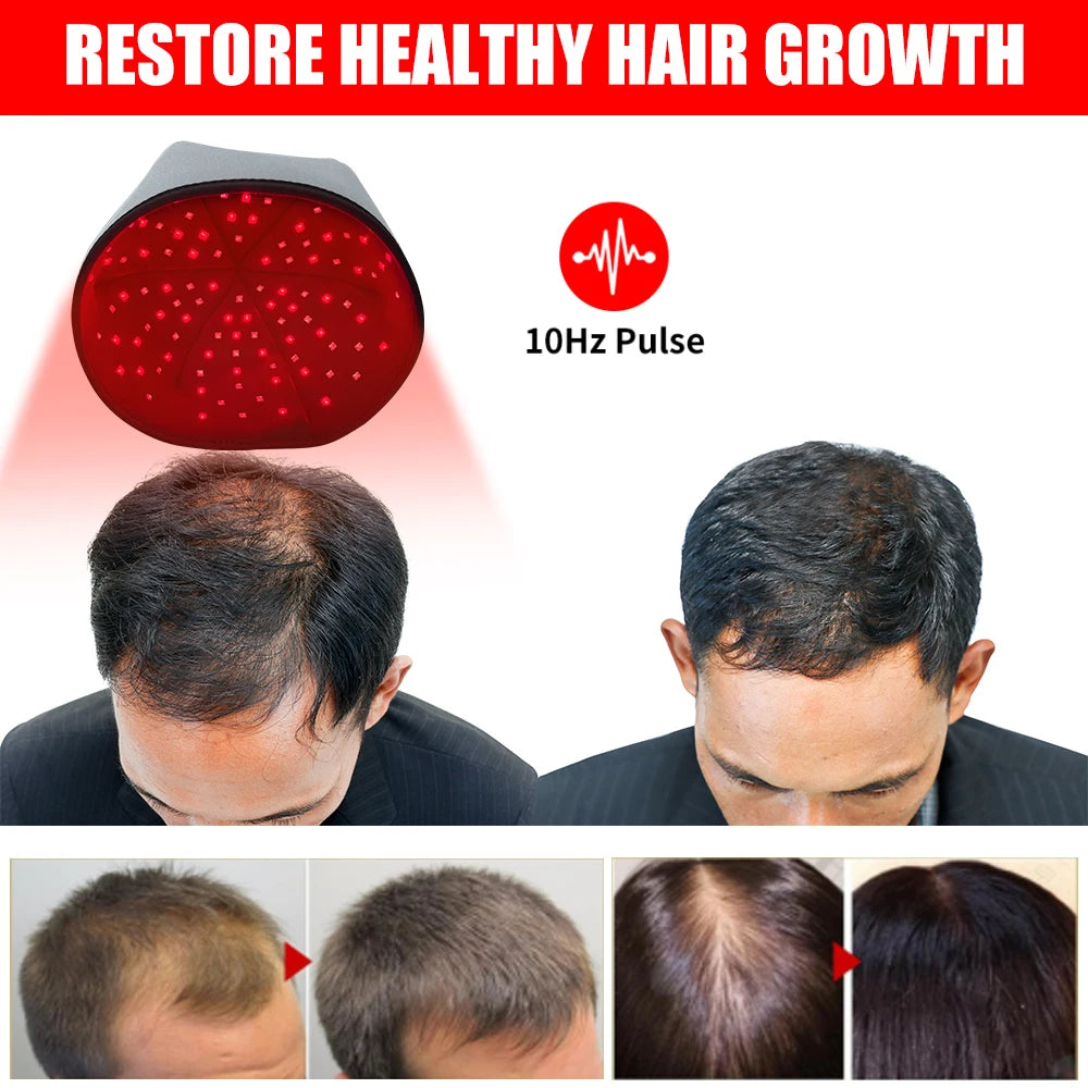 Red Light Therapy Cap for Hair Regrowth, 660nm 830nm Infrared Hair Growth Hat for Hair Loss & Thinning Repair