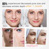 3 Colors LED Light Therapy Face Mask, 288 Beams 850nm Near-Infrared Photon Mask for Anti-Aging & Skin Rejuvenation