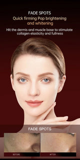 320 LED Red Light Therapy Mask - 3D Silicone Face & Neck Device for Anti-Aging & Acne Care