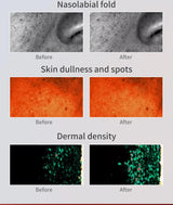 Infrared LED Face & Neck Mask - 676 Beams Red & Green Light Therapy for Dark Spots & Anti-Aging