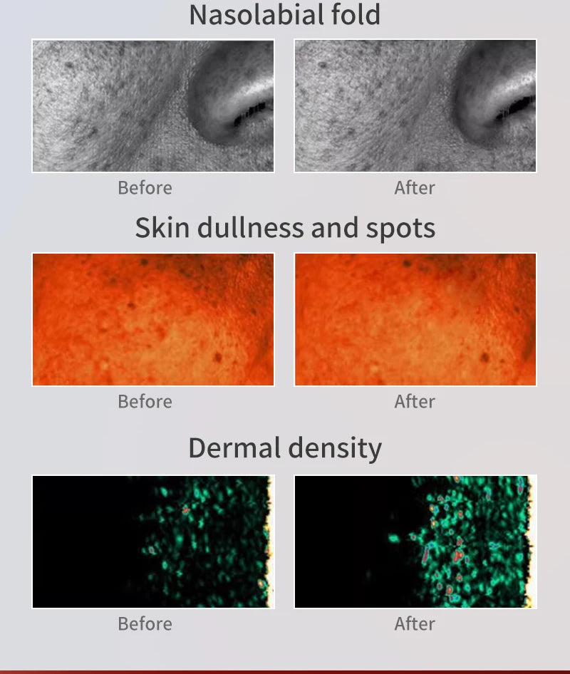Infrared LED Face & Neck Mask - 676 Beams Red & Green Light Therapy for Dark Spots & Anti-Aging