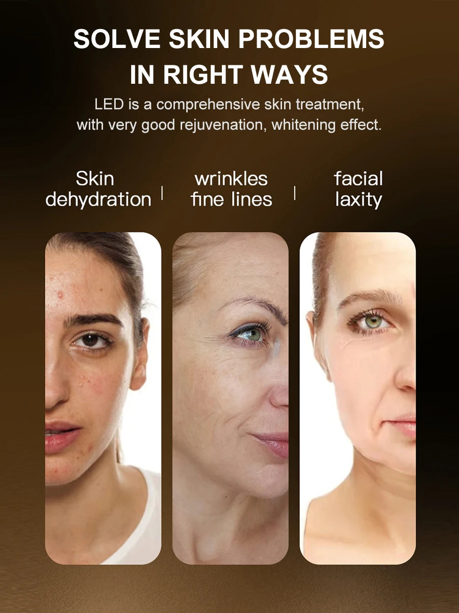 Professional 807 LED Face & Neck Light Therapy Mask - Infrared & 3-Color Therapy for Anti-Aging & Acne