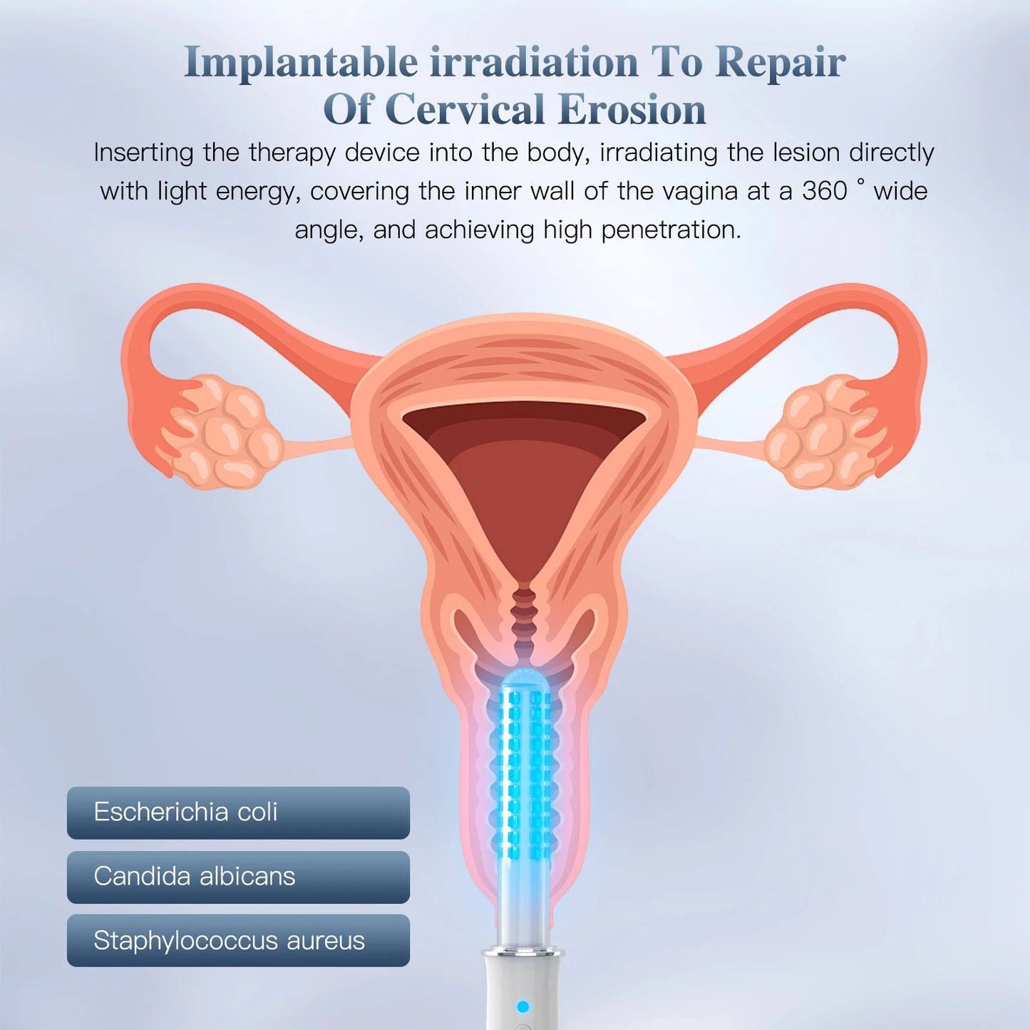 Wireless Vaginal Red Light Therapy Device, Blue Light Massager for Vaginal Tightening, Vaginitis Relief & Pelvic Care