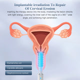 Wireless Vaginal Red Light Therapy Device, Blue Light Massager for Vaginal Tightening, Vaginitis Relief & Pelvic Care