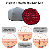 Red Light Therapy Cap for Hair Regrowth, 660nm 830nm Infrared Hair Growth Hat for Hair Loss & Thinning Repair