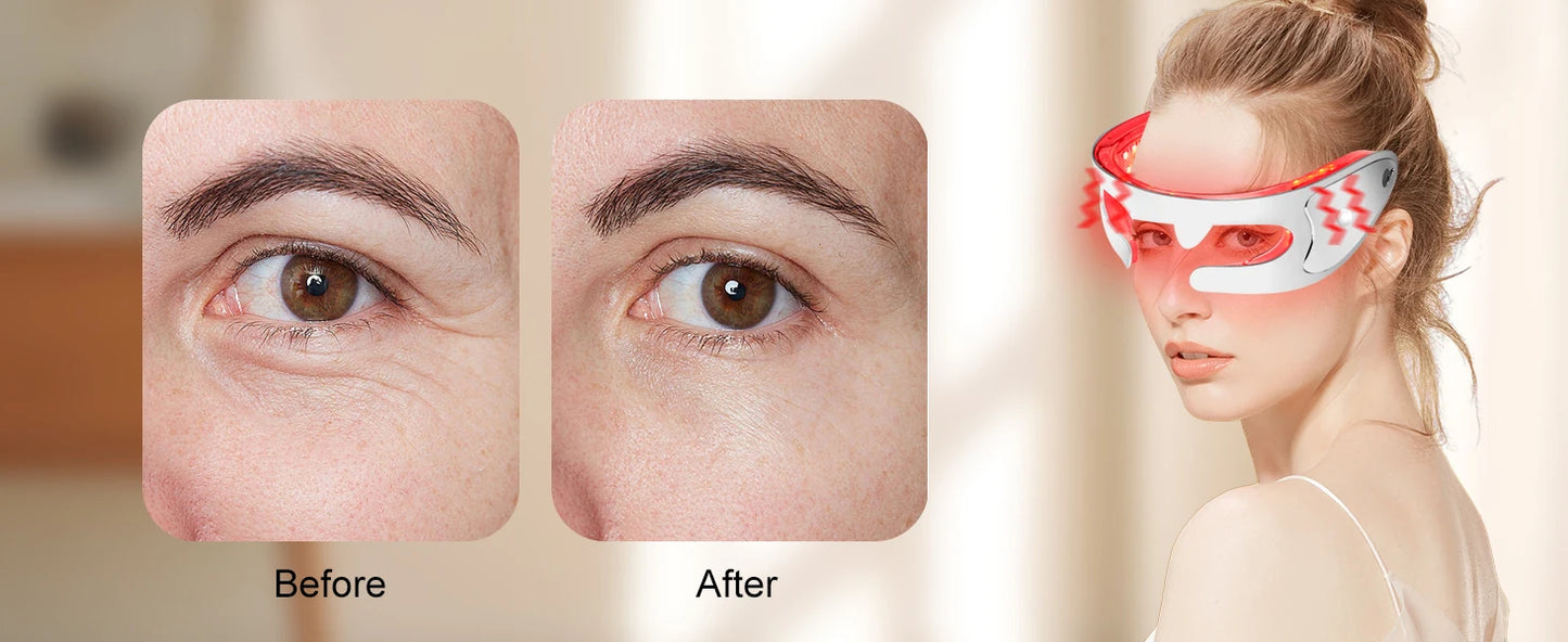 Red Light Therapy Eye Massager, Vibration LED Eye Mask for Dark Circles, Fine Lines & Wrinkle Removal Beauty Device
