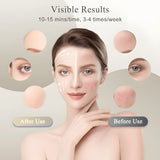 7 Color Silicone LED Face Mask, 309 LEDs Red Light Therapy Device for Anti-Aging, Skin Rejuvenation & Wrinkle Removal