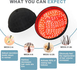 236 Diodes LED Hair Growth Cap | Red & Blue Light for Scalp & Hair Appearance