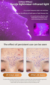 LED Cat-Ear Red Light Therapy Face Mask - Anti-Aging & Acne Treatment - Portable Photon Facial Skin Rejuvenation Tool