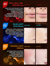 Professional 807 LED Face & Neck Light Therapy Mask - Infrared & 3-Color Therapy for Anti-Aging & Acne