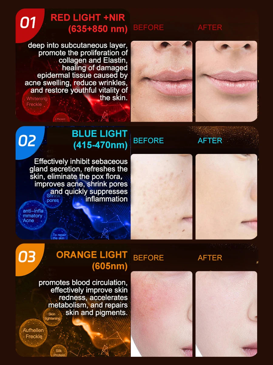 Professional 807 LED Face & Neck Light Therapy Mask - Infrared & 3-Color Therapy for Anti-Aging & Acne