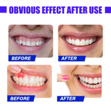 Red Light Therapy for Gums & Teeth, 625nm LED Oral Care Device for Periodontal Treatment, Toothache & Sensitivity Relief