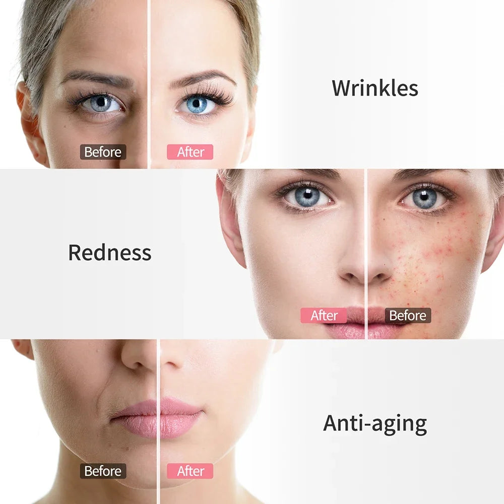 3 Colors LED Light Therapy Face Mask, 288 Beams 850nm Near-Infrared Photon Mask for Anti-Aging & Skin Rejuvenation