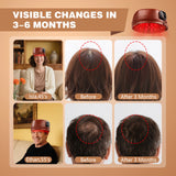 Wireless Red Light Therapy Cap for Hair Regrowth, 120 LEDs 660nm 850nm Infrared Hat for Anti-Hair Loss & Thicker Hair