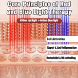 Medical Grade Neck Wearable Laser Therapy Device | 650nm LLLT with 72 Diodes for Blood Pressure & Lipid Management