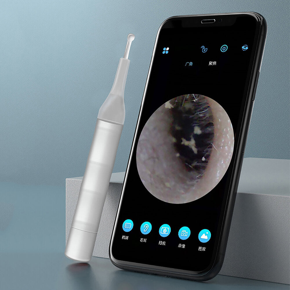 5MP HD WiFi Intelligent Ear Endoscope, 4-Axis Temp Control, IP67 Waterproof, Long Battery Life, Luminous Visual Ear Picker