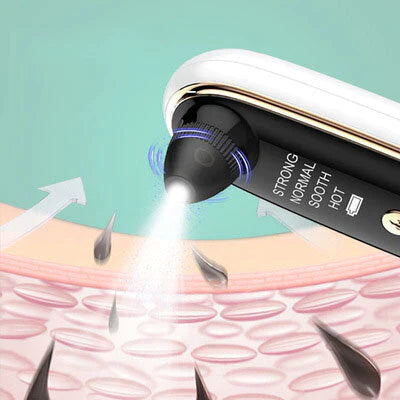 Multi-Gear Skin-Friendly WiFi Camera Blackhead Remover for Facial Cleaning and Skin Care