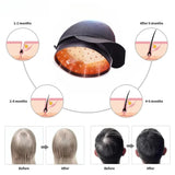 LLLT Hair & Scalp Wellness Helmet | Laser Therapy Device (Up to 272 Diodes)