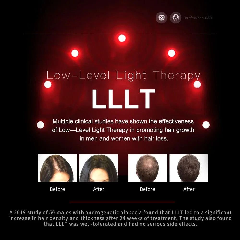 212 LLLT Red Light Laser Cap for Hair Regrowth – Stop Hair Loss, Strengthen Roots, Promote Thicker Hair