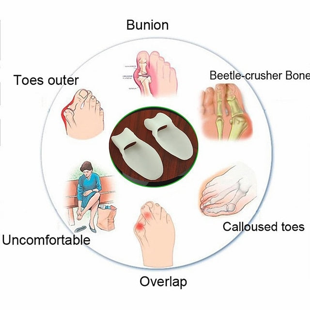 Unisex Silicone Bunion Splint & Toe Separator for Hallux Valgus Relief