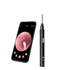 Smart Visible Earpick: Rechargeable 200W Pixel, IP67 Waterproof Lens, Earwax Remover Cleaner