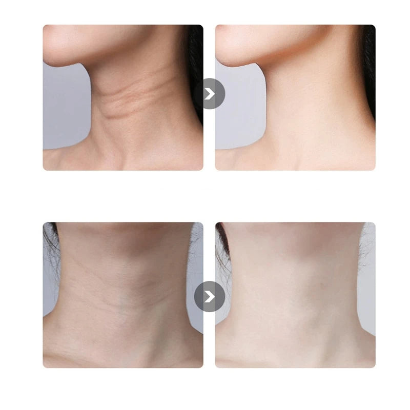 Neck Photon Therapy Heating Wrinkle Removal Reduce Double Chin Skin Lifting Machine